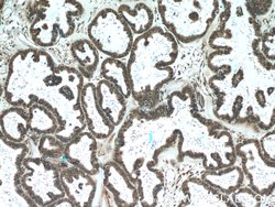 L1TD1 Rabbit anti-Human, Polyclonal, Proteintech 150 &mu;L; Unconjugated:Antibodies,