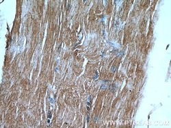 FAM120A Rabbit anti-Human, Mouse, Rat, Polyclonal, Proteintech 150 &mu;L;