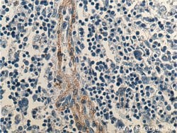 FCGR2B / CD32b Rabbit anti-Human, Polyclonal, Proteintech 150 &mu;L; Unconjugated:Antibodies,