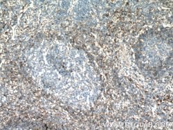 FCGR2B / CD32b Rabbit anti-Human, Polyclonal, Proteintech 150 &mu;L; Unconjugated:Antibodies,