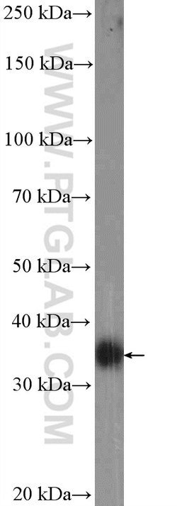 FCGR2B / CD32b Rabbit anti-Human, Polyclonal, Proteintech 150 &mu;L; Unconjugated:Antibodies,