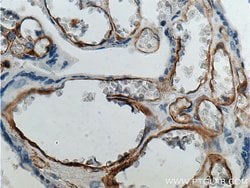 FCGR2B / CD32b Rabbit anti-Human, Polyclonal, Proteintech 150 &mu;L; Unconjugated:Antibodies,