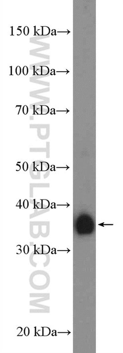 FCGR2B / CD32b Rabbit anti-Human, Polyclonal, Proteintech 150 &mu;L; Unconjugated:Antibodies,