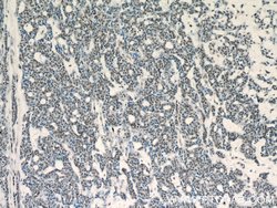 GABPA Rabbit anti-Human, Mouse, Rat, Polyclonal, Proteintech 150 &mu;L;