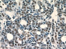 GABPA Rabbit anti-Human, Mouse, Rat, Polyclonal, Proteintech 150 &mu;L;