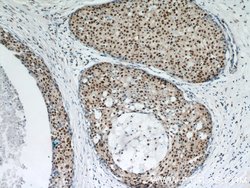 GABPA Rabbit anti-Human, Mouse, Rat, Polyclonal, Proteintech 150 &mu;L;