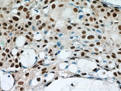 GABPA Rabbit anti-Human, Mouse, Rat, Polyclonal, Proteintech 150 &mu;L;