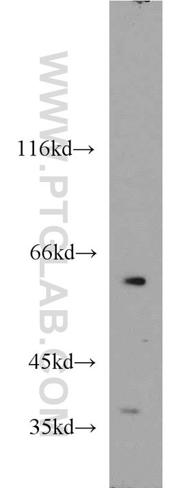 GABPA Rabbit anti-Human, Mouse, Rat, Polyclonal, Proteintech 150 &mu;L;