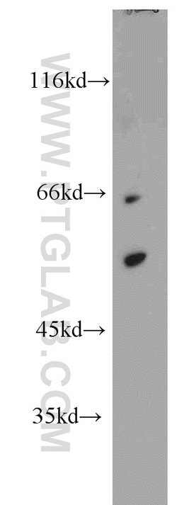 GABPA Rabbit anti-Human, Mouse, Rat, Polyclonal, Proteintech 150 &mu;L;