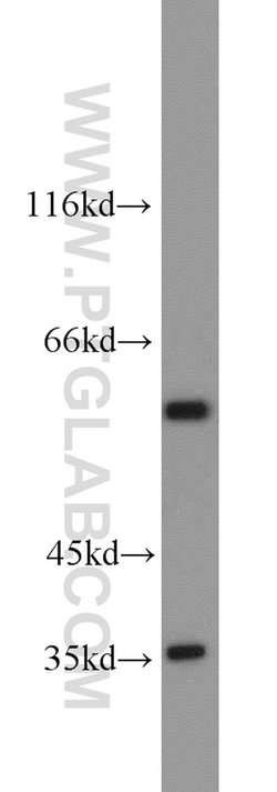 GABPA Rabbit anti-Human, Mouse, Rat, Polyclonal, Proteintech 150 &mu;L;
