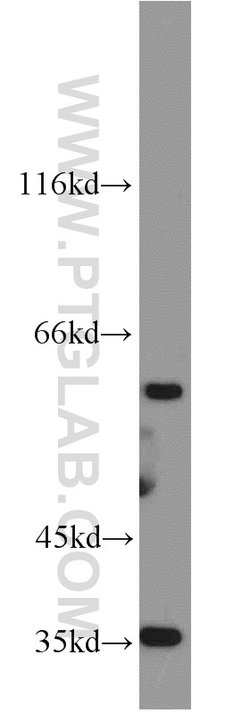 GABPA Rabbit anti-Human, Mouse, Rat, Polyclonal, Proteintech 150 &mu;L;