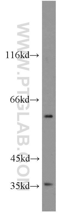 GABPA Rabbit anti-Human, Mouse, Rat, Polyclonal, Proteintech 150 &mu;L;
