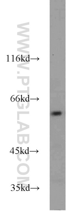 GABPA Rabbit anti-Human, Mouse, Rat, Polyclonal, Proteintech 150 &mu;L;