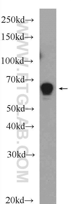 GABPA Rabbit anti-Human, Mouse, Rat, Polyclonal, Proteintech 150 &mu;L;
