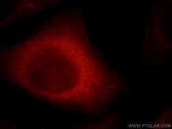 CYP26B1 Rabbit anti-Human, Mouse, Rat, Polyclonal, Proteintech:Antibodies:Primary