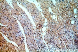 CYP26B1 Rabbit anti-Human, Mouse, Rat, Polyclonal, Proteintech:Antibodies:Primary