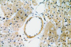CYP26B1 Rabbit anti-Human, Mouse, Rat, Polyclonal, Proteintech:Antibodies:Primary
