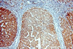 CYP26B1 Rabbit anti-Human, Mouse, Rat, Polyclonal, Proteintech:Antibodies:Primary