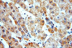 CYP26B1 Rabbit anti-Human, Mouse, Rat, Polyclonal, Proteintech:Antibodies:Primary
