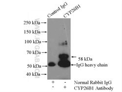 CYP26B1 Rabbit anti-Human, Mouse, Rat, Polyclonal, Proteintech:Antibodies:Primary