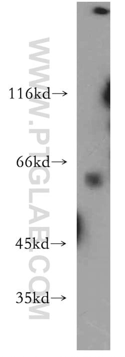 CYP26B1 Rabbit anti-Human, Mouse, Rat, Polyclonal, Proteintech:Antibodies:Primary