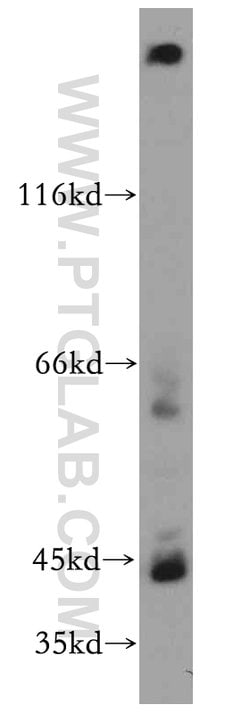 CYP26B1 Rabbit anti-Human, Mouse, Rat, Polyclonal, Proteintech:Antibodies:Primary