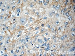 TOAG1 Rabbit anti-Human, Polyclonal, Proteintech 20 &mu;L | Buy Online | Proteintech | Fisher Scientific