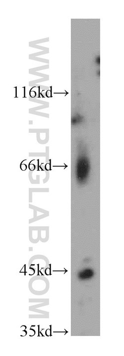 LHX5 Rabbit anti-Human, Polyclonal, Proteintech 20 &mu;L; Unconjugated:Antibodies,