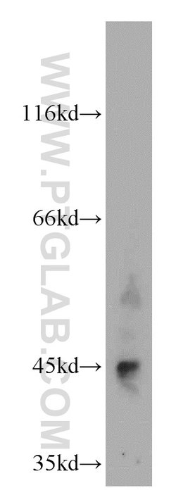 LHX5 Rabbit anti-Human, Polyclonal, Proteintech 20 &mu;L; Unconjugated:Antibodies,