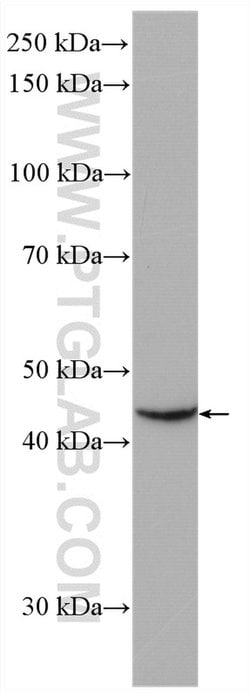 LHX5 Rabbit anti-Human, Polyclonal, Proteintech 20 &mu;L; Unconjugated:Antibodies,