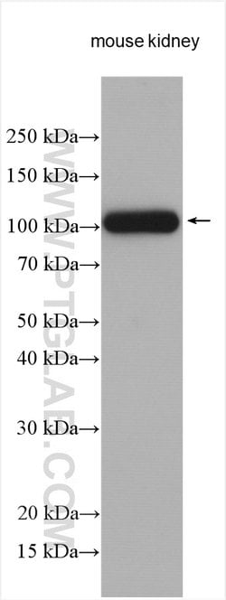 ATP6V0A4 Rabbit anti-Human, Mouse, Polyclonal, ProteinTech 150 &mu;L; Unconjugated:Antibodies,