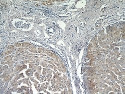 MOGAT1 Rabbit anti-Human, Mouse, Rat, Polyclonal, Proteintech 150 &mu;L;
