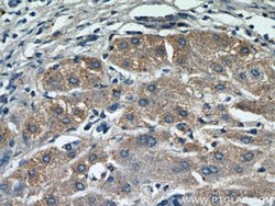 MOGAT1 Rabbit anti-Human, Mouse, Rat, Polyclonal, Proteintech 150 &mu;L;