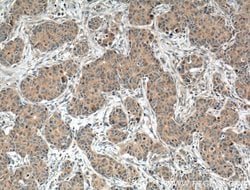 TNFR1 Rabbit anti-Human, Mouse, Polyclonal, Proteintech:Antibodies:Primary