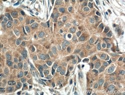 TNFR1 Rabbit anti-Human, Mouse, Polyclonal, Proteintech:Antibodies:Primary