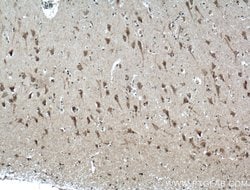 TNFR1 Rabbit anti-Human, Mouse, Polyclonal, Proteintech:Antibodies:Primary