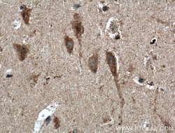TNFR1 Rabbit anti-Human, Mouse, Polyclonal, Proteintech:Antibodies:Primary