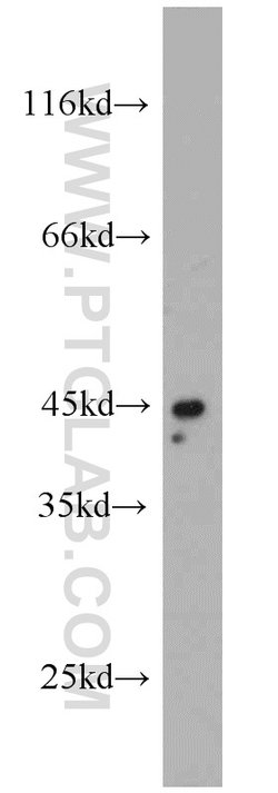 TNFR1 Rabbit anti-Human, Mouse, Polyclonal, Proteintech:Antibodies:Primary