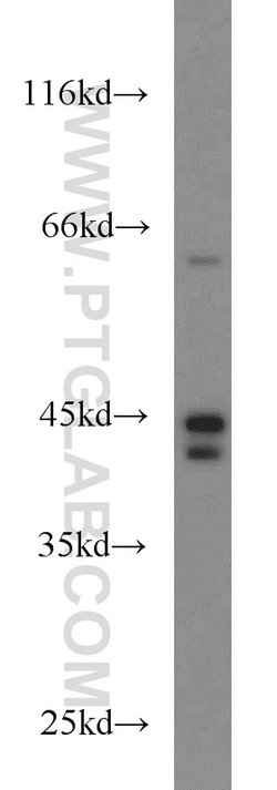 TNFR1 Rabbit anti-Human, Mouse, Polyclonal, Proteintech:Antibodies:Primary