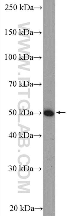 TNFR1 Rabbit anti-Human, Mouse, Polyclonal, Proteintech:Antibodies:Primary