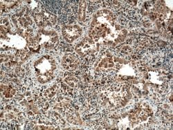 CYP2F1 Rabbit anti-Human, Mouse, Rat, Polyclonal, Proteintech:Antibodies:Primary