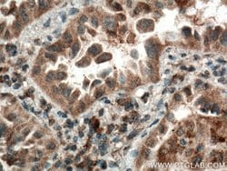 CYP2F1 Rabbit anti-Human, Mouse, Rat, Polyclonal, Proteintech:Antibodies:Primary