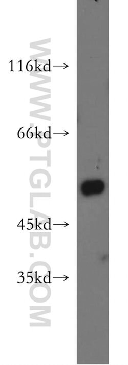 CYP2F1 Rabbit anti-Human, Mouse, Rat, Polyclonal, Proteintech:Antibodies:Primary