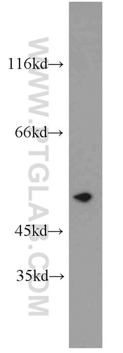 CYP2F1 Rabbit anti-Human, Mouse, Rat, Polyclonal, Proteintech:Antibodies:Primary