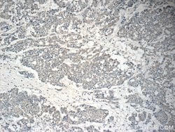 NGX6 Rabbit anti-Human, Polyclonal, Proteintech:Antibodies:Primary Antibodies
