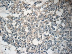 NGX6 Rabbit anti-Human, Polyclonal, Proteintech:Antibodies:Primary Antibodies