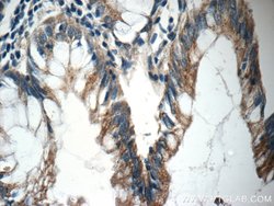 NGX6 Rabbit anti-Human, Polyclonal, Proteintech:Antibodies:Primary Antibodies