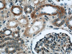MRPL28 Rabbit anti-Human, Mouse, Rat, Polyclonal, Proteintech:Antibodies:Primary