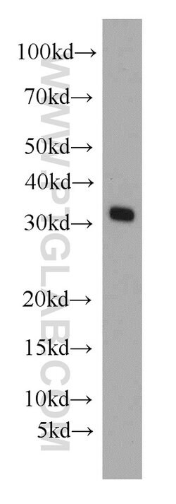MRPL28 Rabbit anti-Human, Mouse, Rat, Polyclonal, Proteintech:Antibodies:Primary
