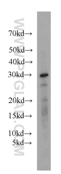 MRPL28 Rabbit anti-Human, Mouse, Rat, Polyclonal, Proteintech:Antibodies:Primary